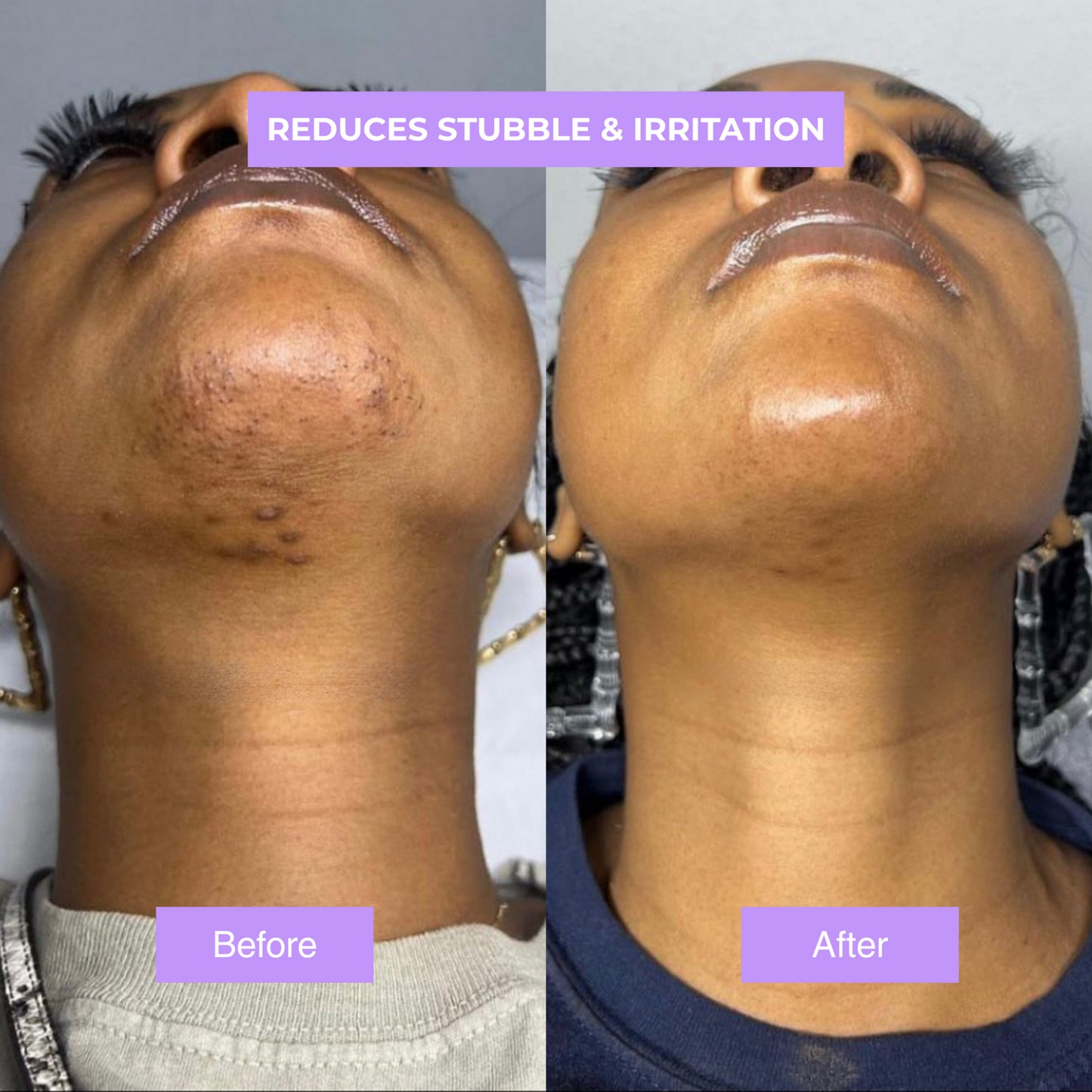 Jenason™ - Cyperus Rotundus Skin Serum