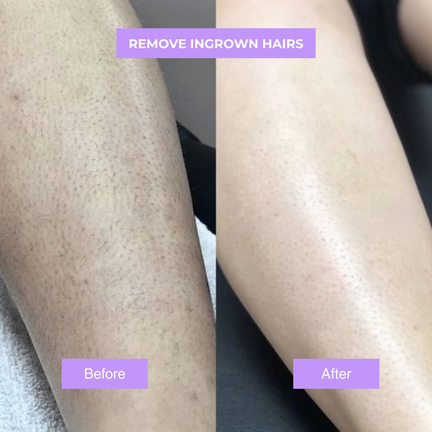 Jenason™ - Cyperus Rotundus Skin Serum