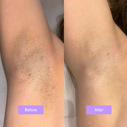 Jenason™ - Cyperus Rotundus Skin Serum